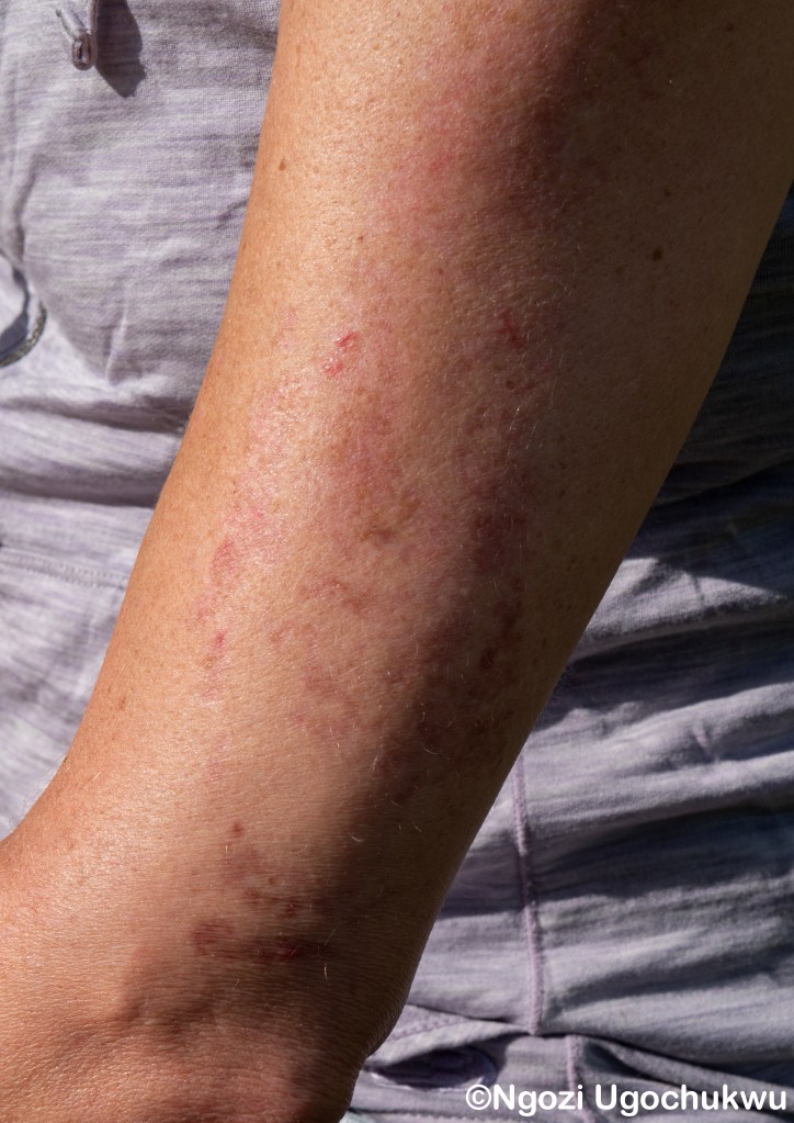 Clark Scar Claire – SCARS
