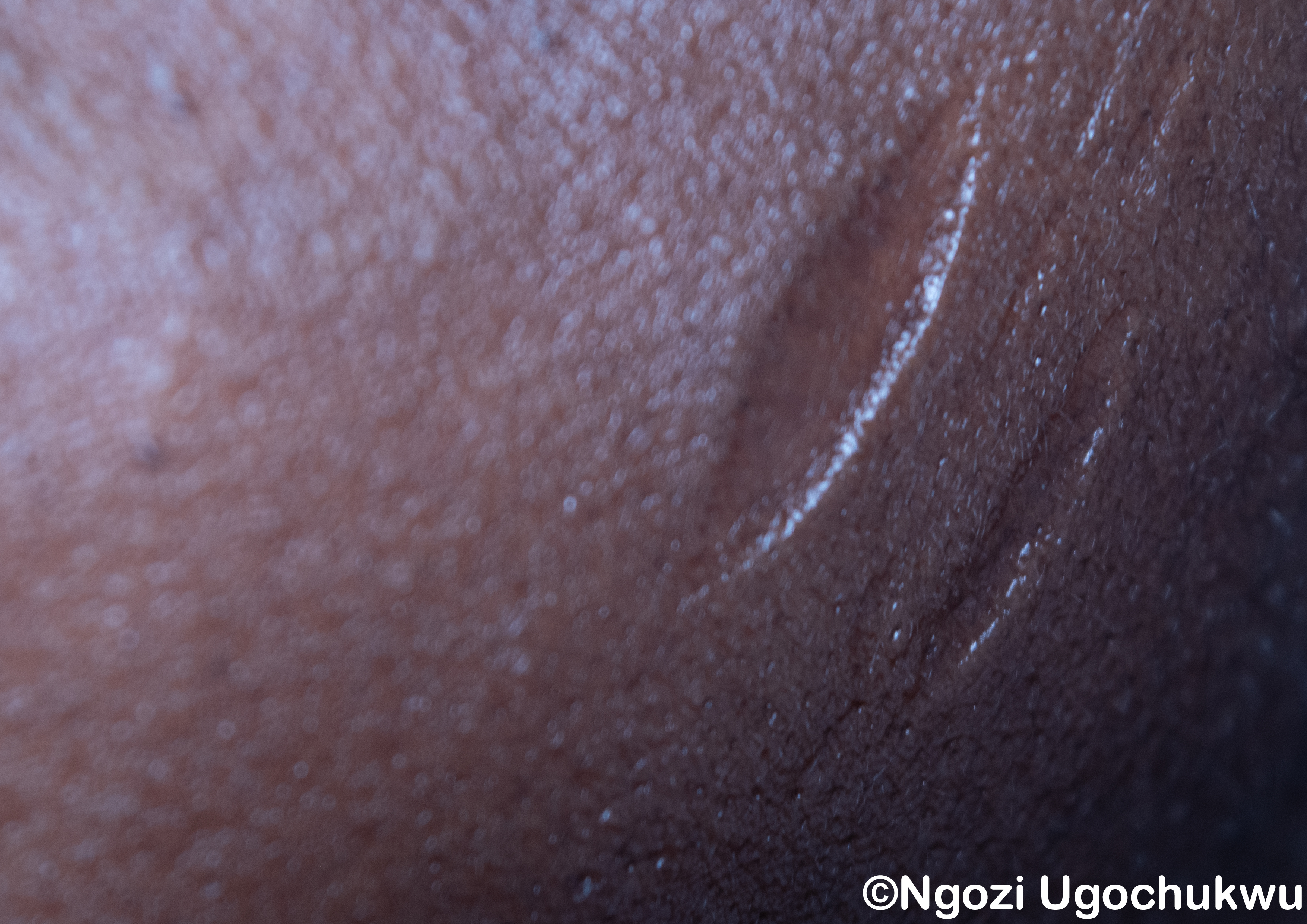 It cuts deep – SCARS